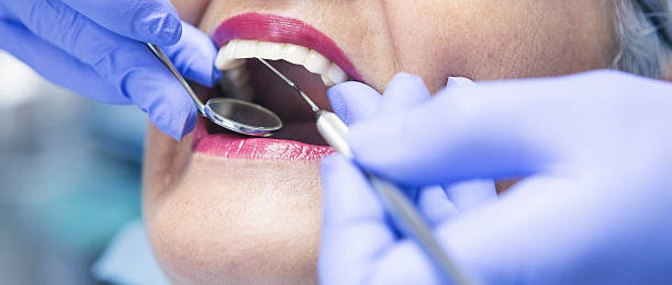 Best Emergency Treatment for Toothache in Lake City, MN